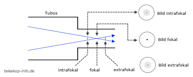 intrafokal fokal extrafokal